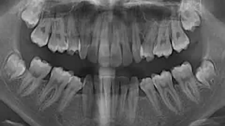 Cbct